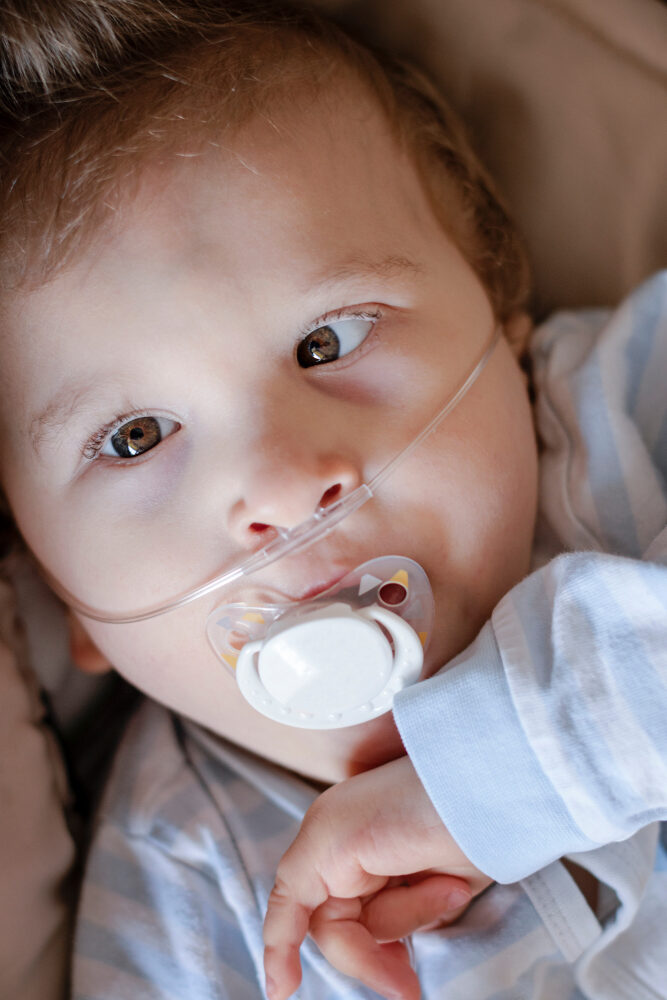 baby,boy,with,cerebral,palsy,is,getting,oxygen,via,nasal